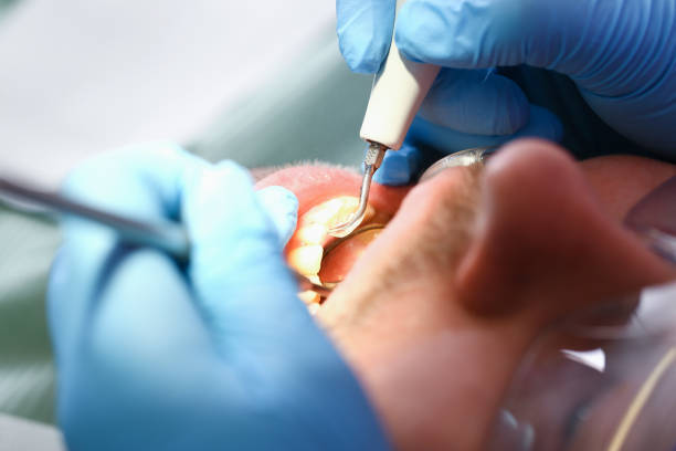 Best Emergency Cosmetic Dentistry in Flat Rock, NC