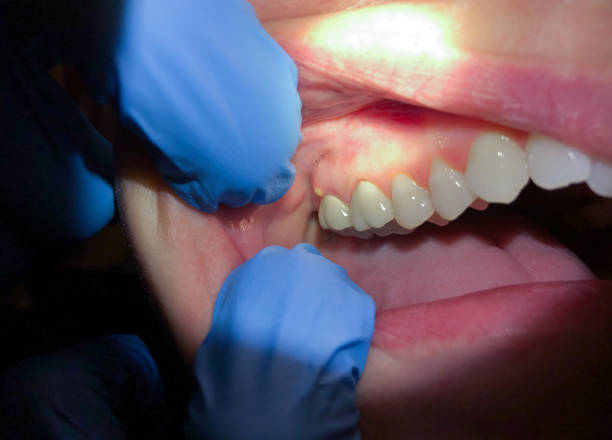 Best Mobile Emergency Dentist in Flat Rock, NC