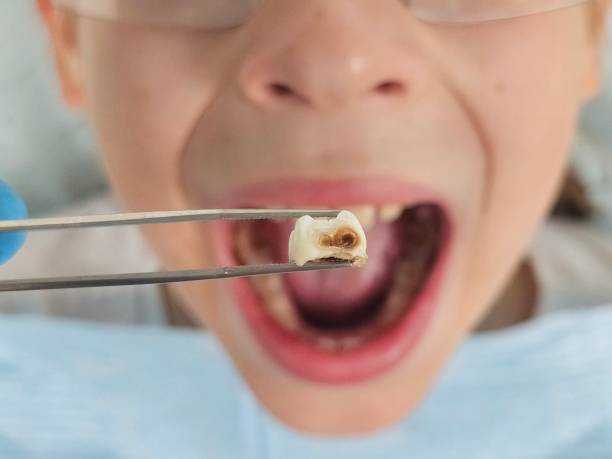 Best Emergency Dentist for Knocked-Out Tooth in Flat Rock, NC