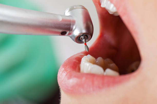 Best Broken or Cracked Tooth Emergency Dentist in Flat Rock, NC